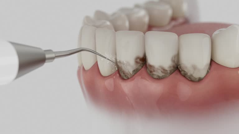Reliable Dental contractor in Fairland, MD by Smile Center Dentistry